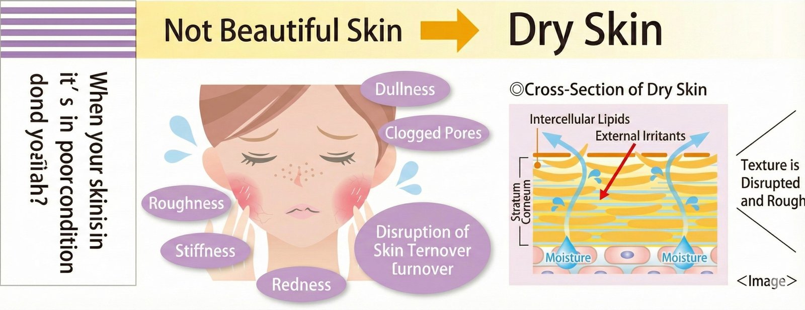 Not Beautiful Skin -> Dry skin